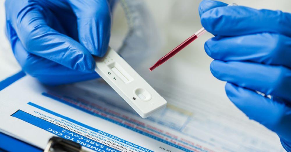 Seit Anfang Juni 2024 ist ein moderater Anstieg der Viruslast im Abwassermonitoring in Nordrhein-Westfalen zu beobachten. Diese regelmäßige Überwachung erfolgt durch Probenentnahmen aus mehreren Klärwerken in NRW und ermöglicht Rückschlüsse auf das Infektionsgeschehen NRW meldet moderaten Anstieg der Covid-19-Fälle